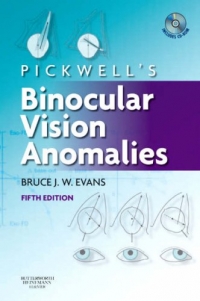 Pickwells Binocular Vision Anomalies