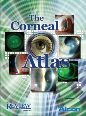 corneal atlas